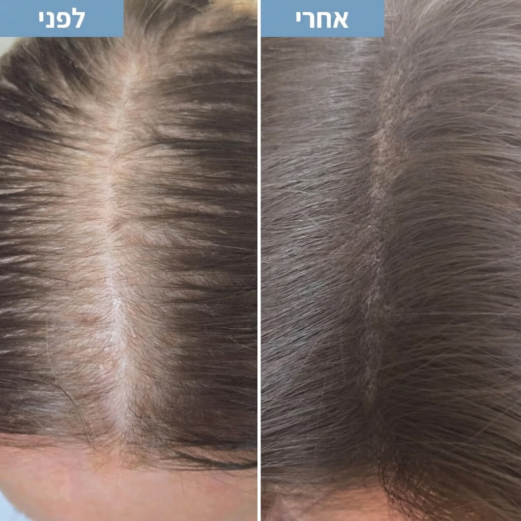 HairShield - ערכה לכיסוי שורשים מהיר ועמיד לאורך כל היום. - דיל ישיר 