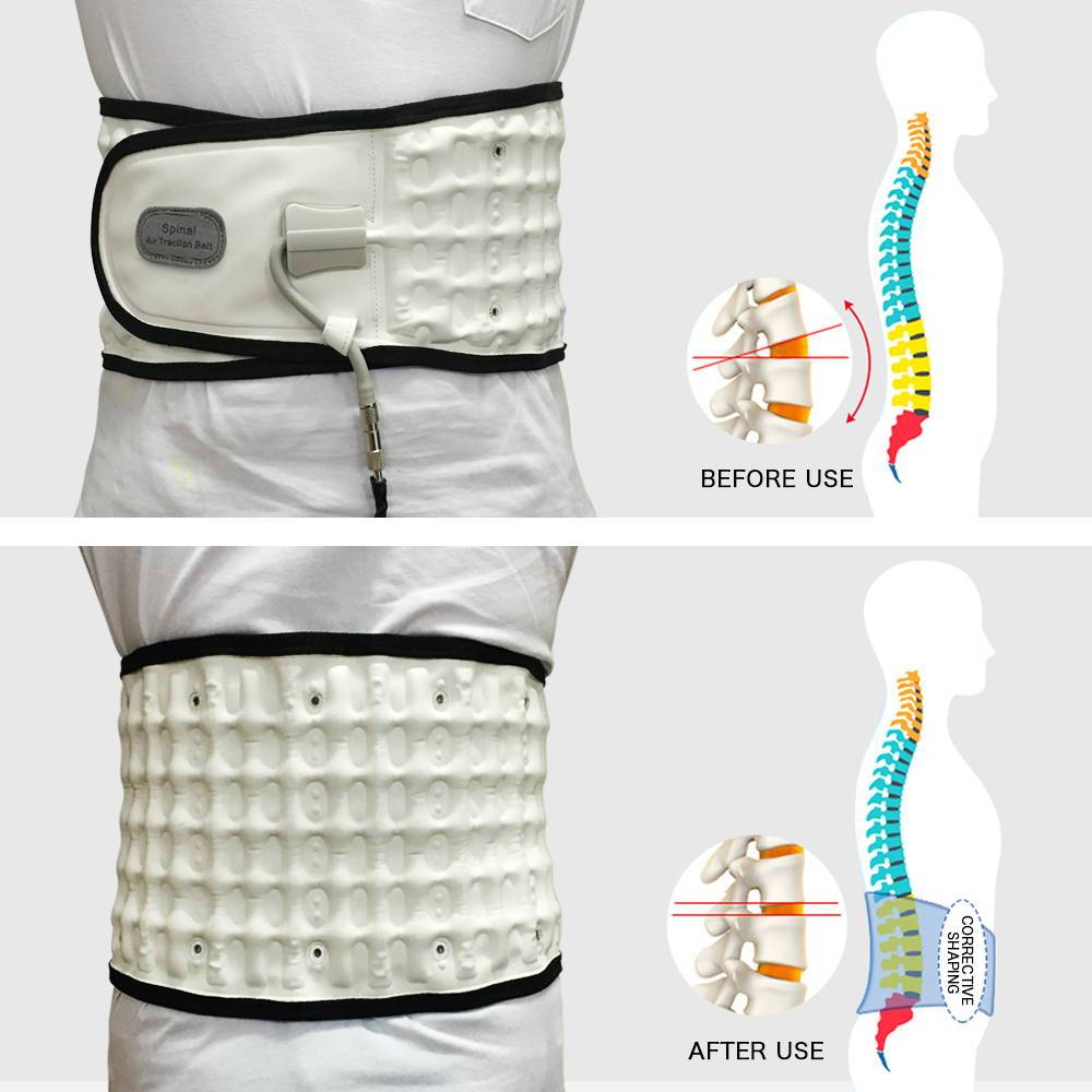 חגורת גב תחתון מתנפחת ומייצבת ליישור הגב והקלה על עמוד שדרה מותני